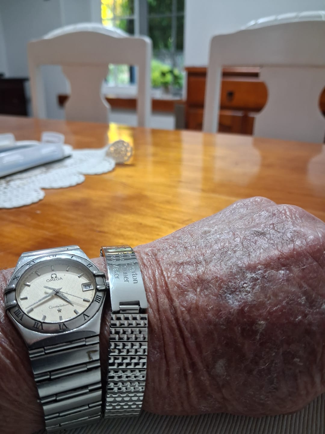 Customer photo review of Stainless Steel Medical Alert ID Stretchable Bracelet