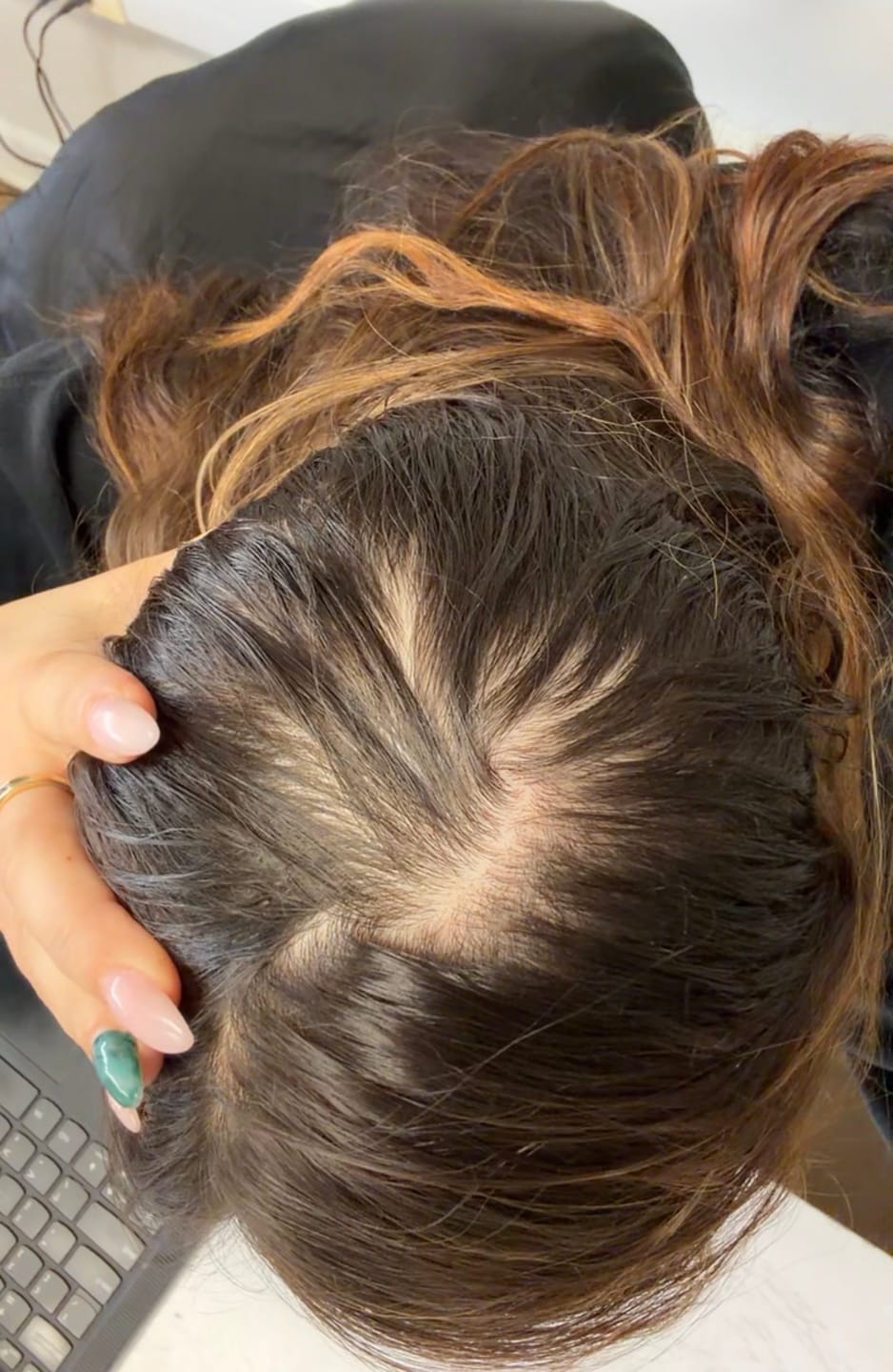 Customer photo review of Complex10™ Hair Growth Supplement