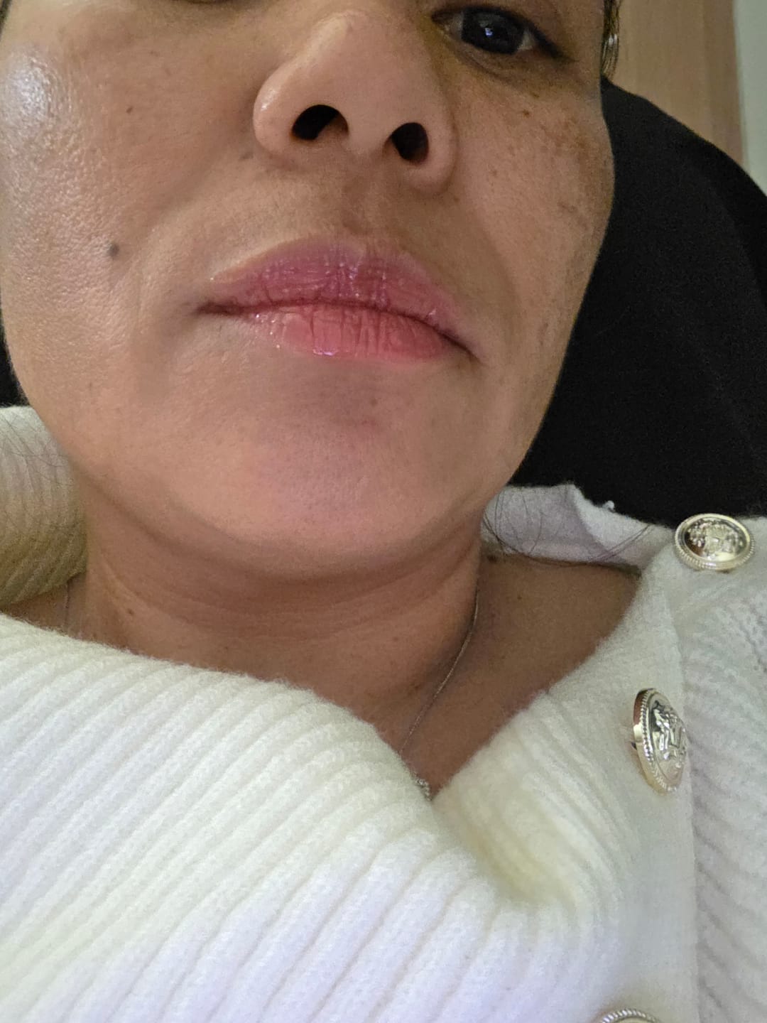 Customer photo review of Triple Lip Plumper Bundle
