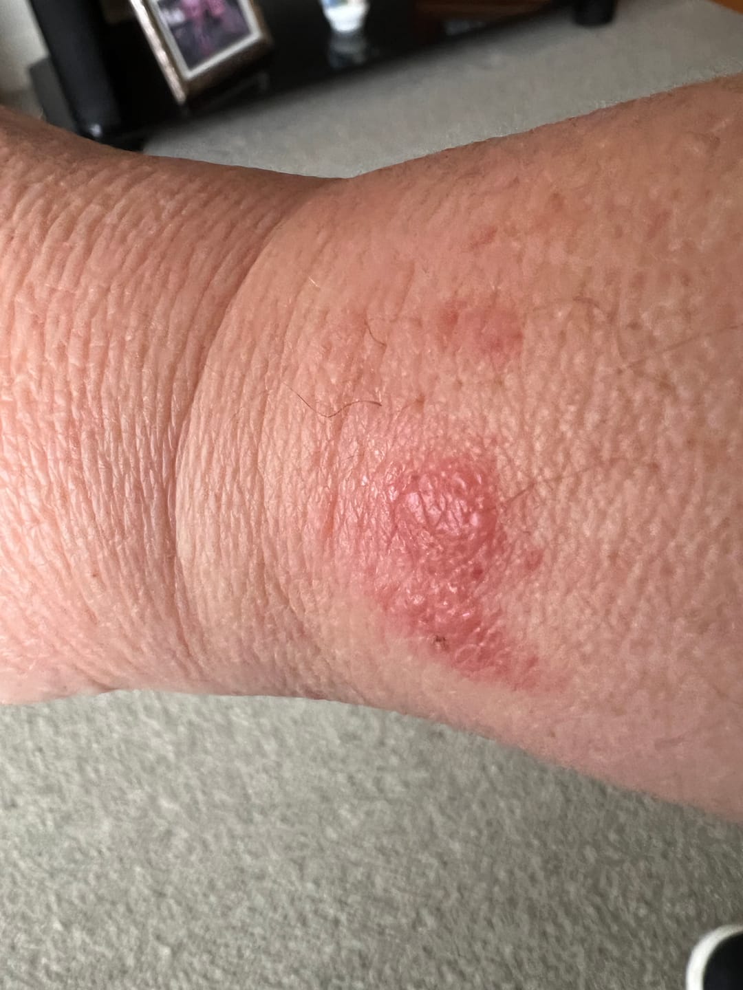 Customer photo review of Personalised Black Mesh Medical Alert Bracelet - Red Logo