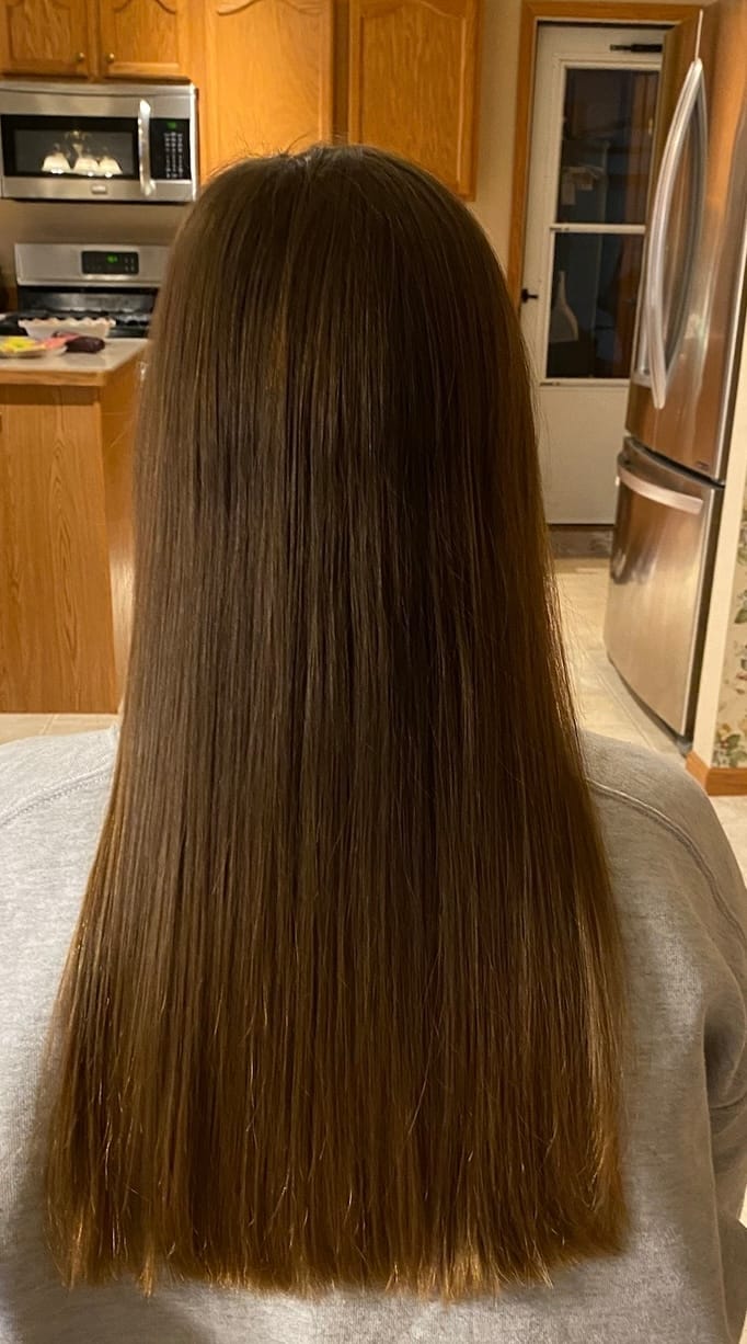 Customer photo review of Vital Scalp Set