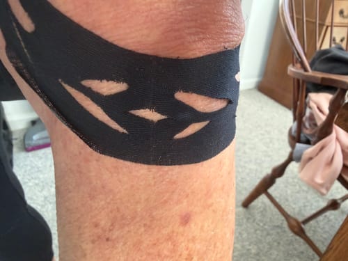 Customer photo review of Easy Kinesiology Tape (30-Day Supply)