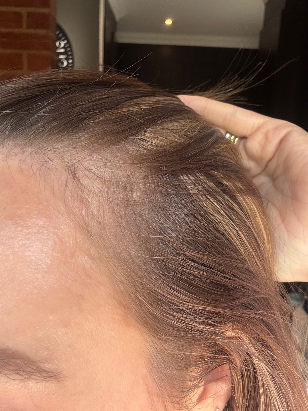 Customer photo review of Glow + Grow Hair Growth Collagen