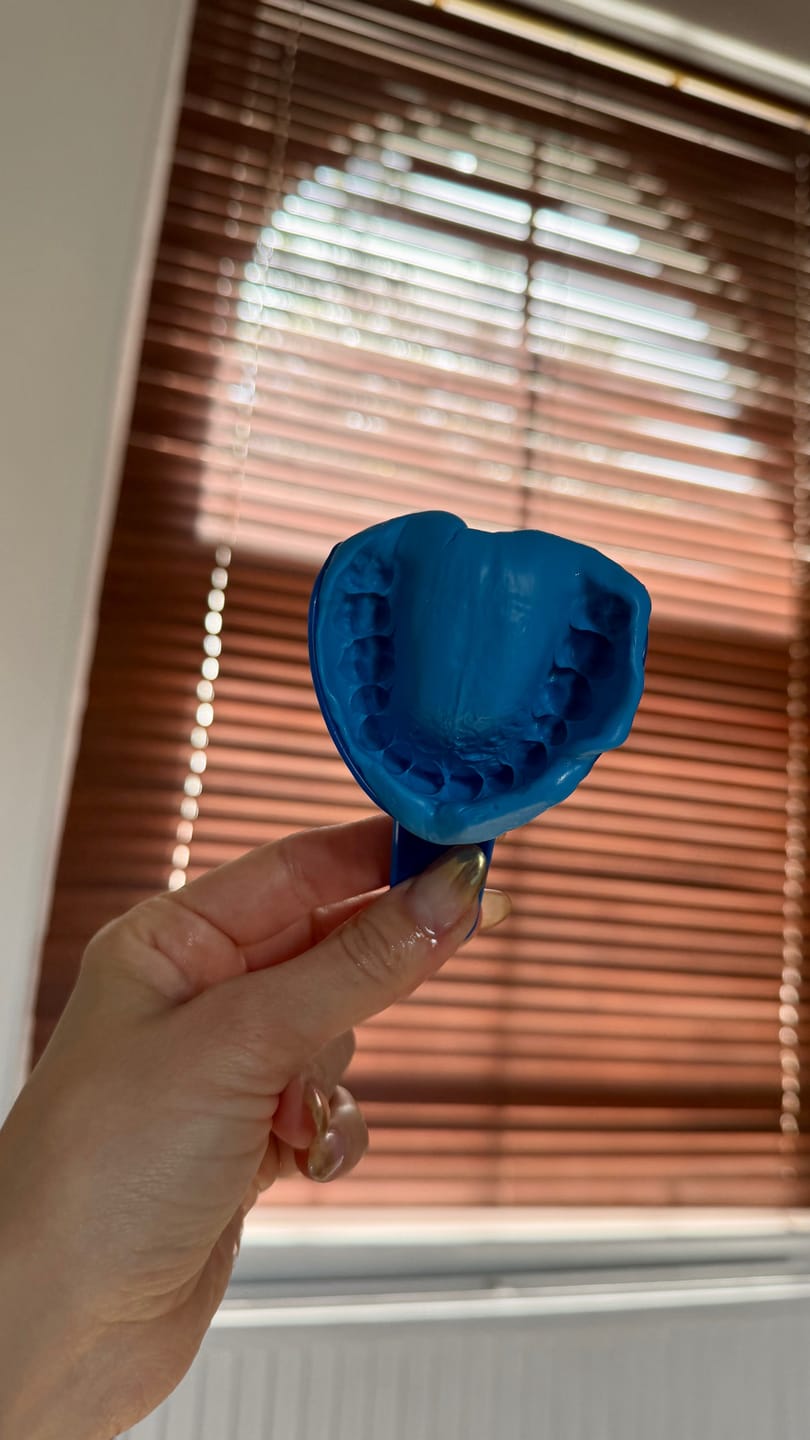 Customer photo review of Upper Impression Kit