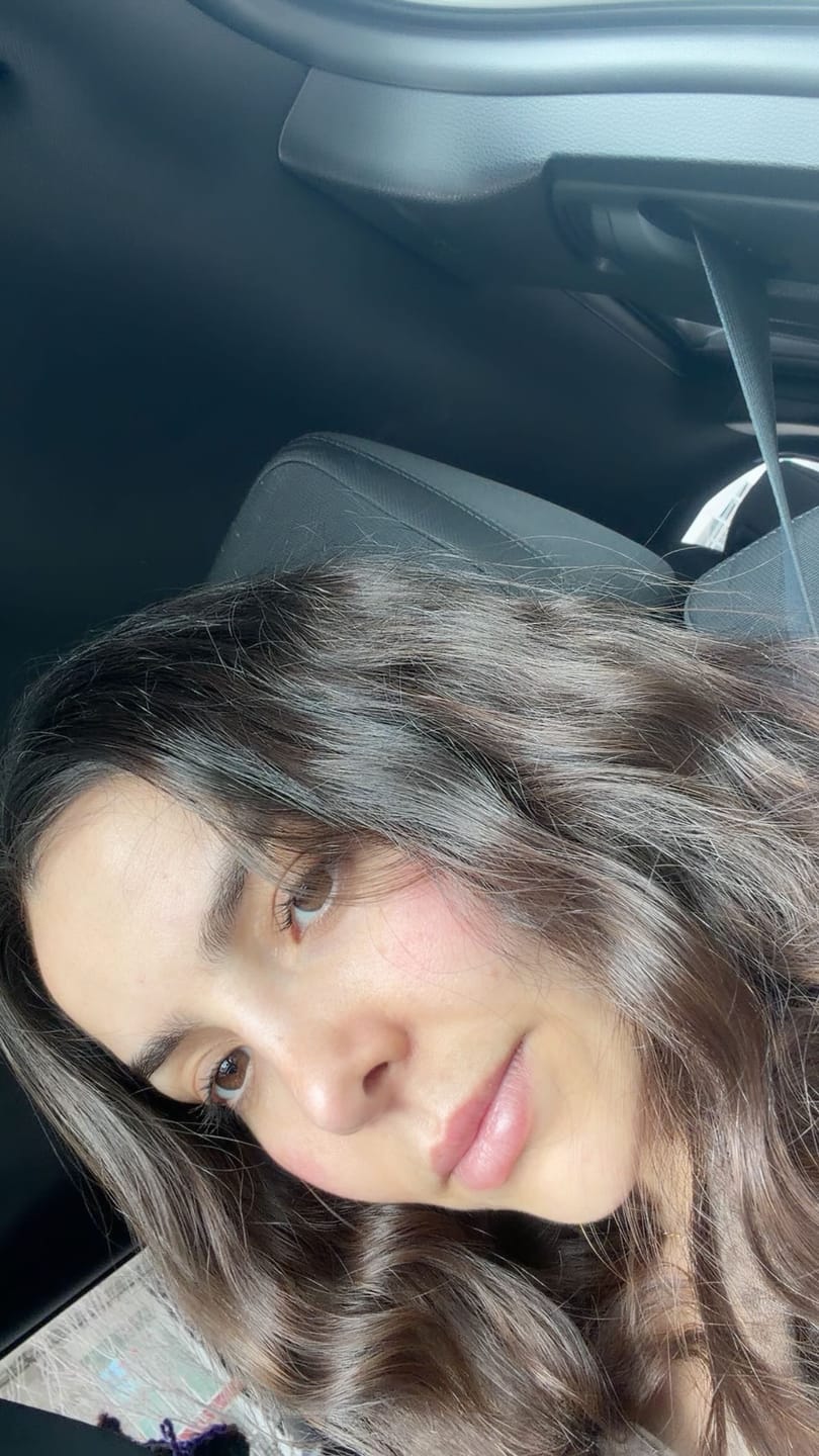 Customer photo review of fLASH EYELASH SERUM