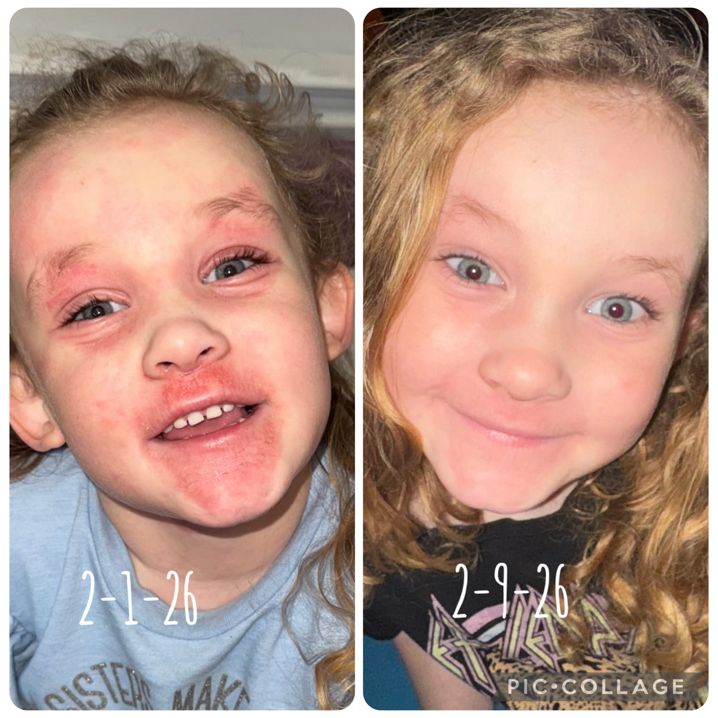 Customer photo review of Healing Salve