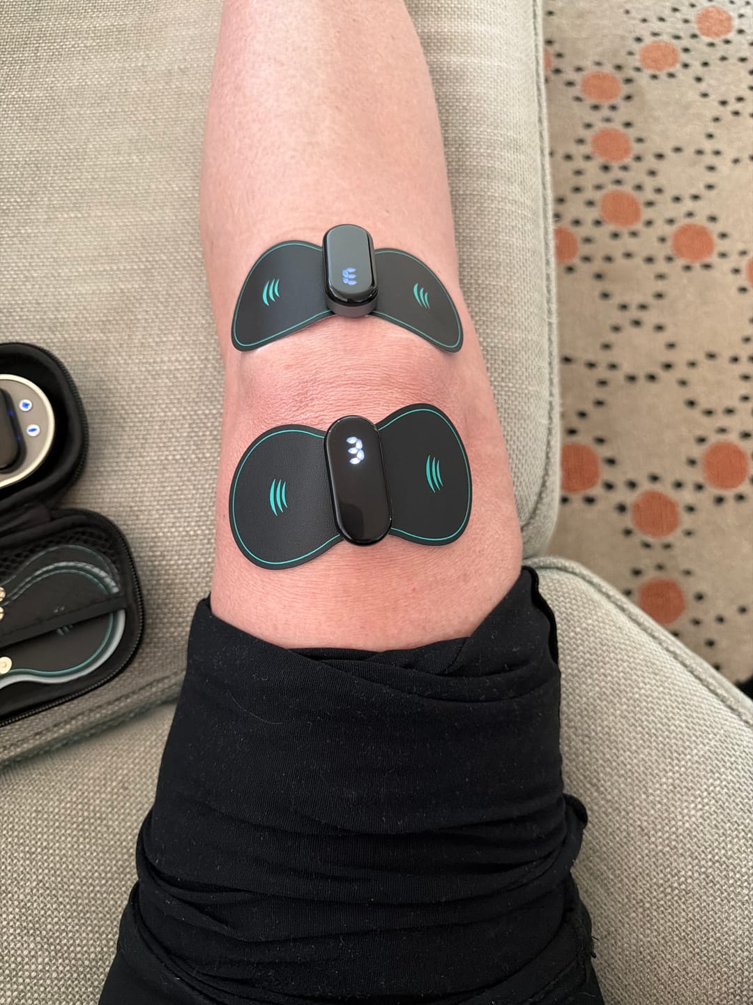 Customer photo review of Vibit TENS - Electrical Nerve Stimulation Therapy