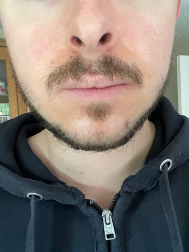 Customer photo review of Seb Natural Soothing Balm