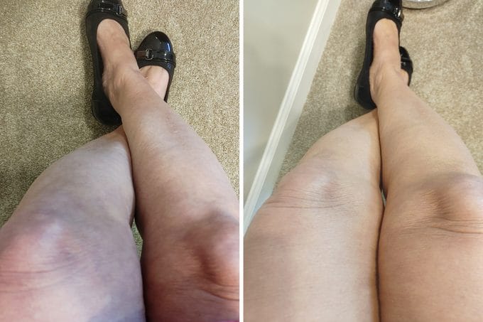 Customer photo review of SkinVeil | Körper Make-up