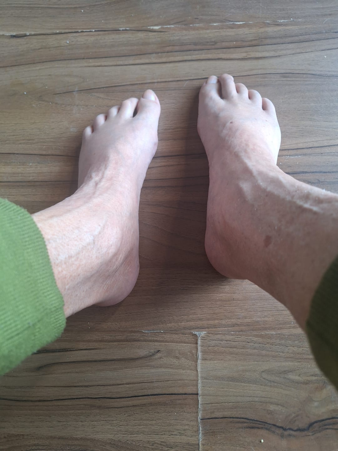 Customer photo review of Outback Pain Relief™ Oil 50ML Roll-On