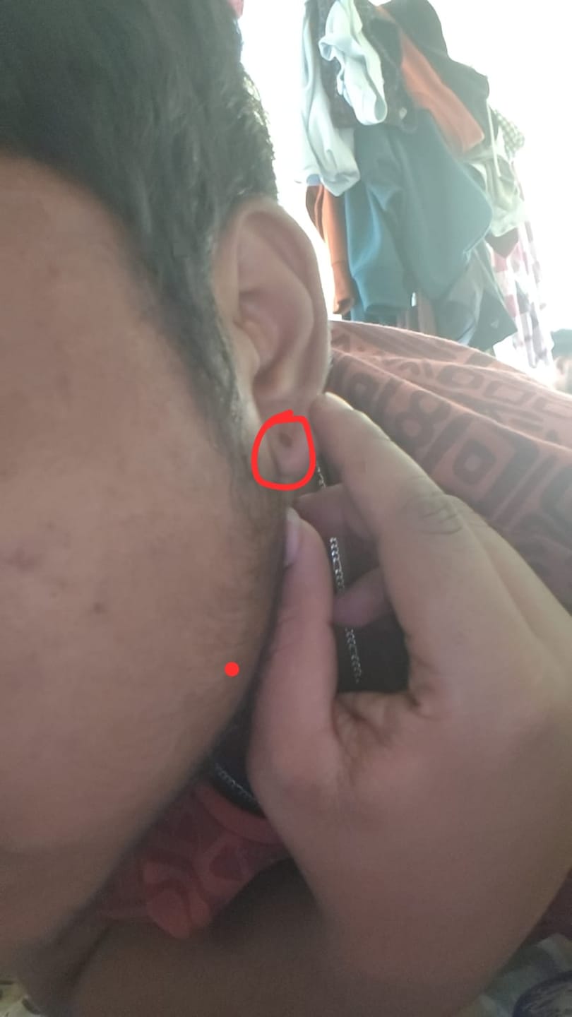 Customer photo review of Round Stud (Magnetic Non-Pierced)
