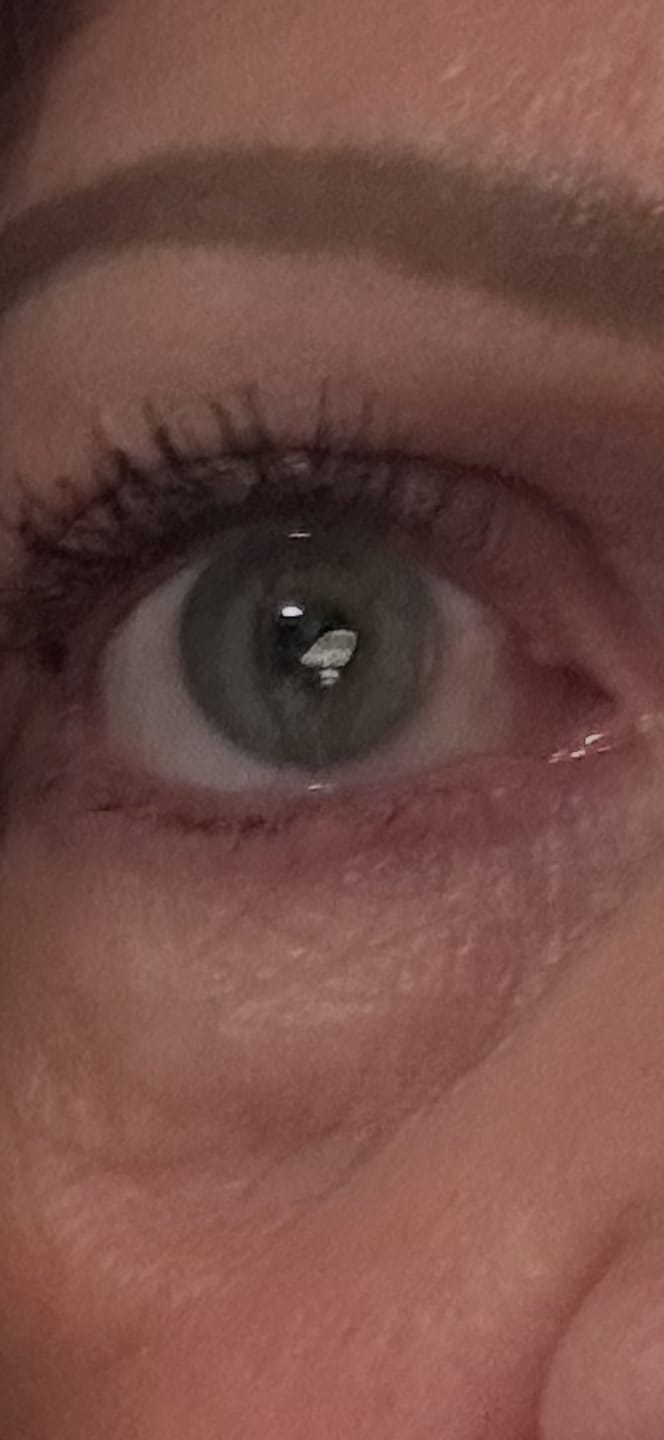 Customer photo review of Eyelash Serum