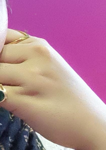 Customer photo review of Linea V Ring