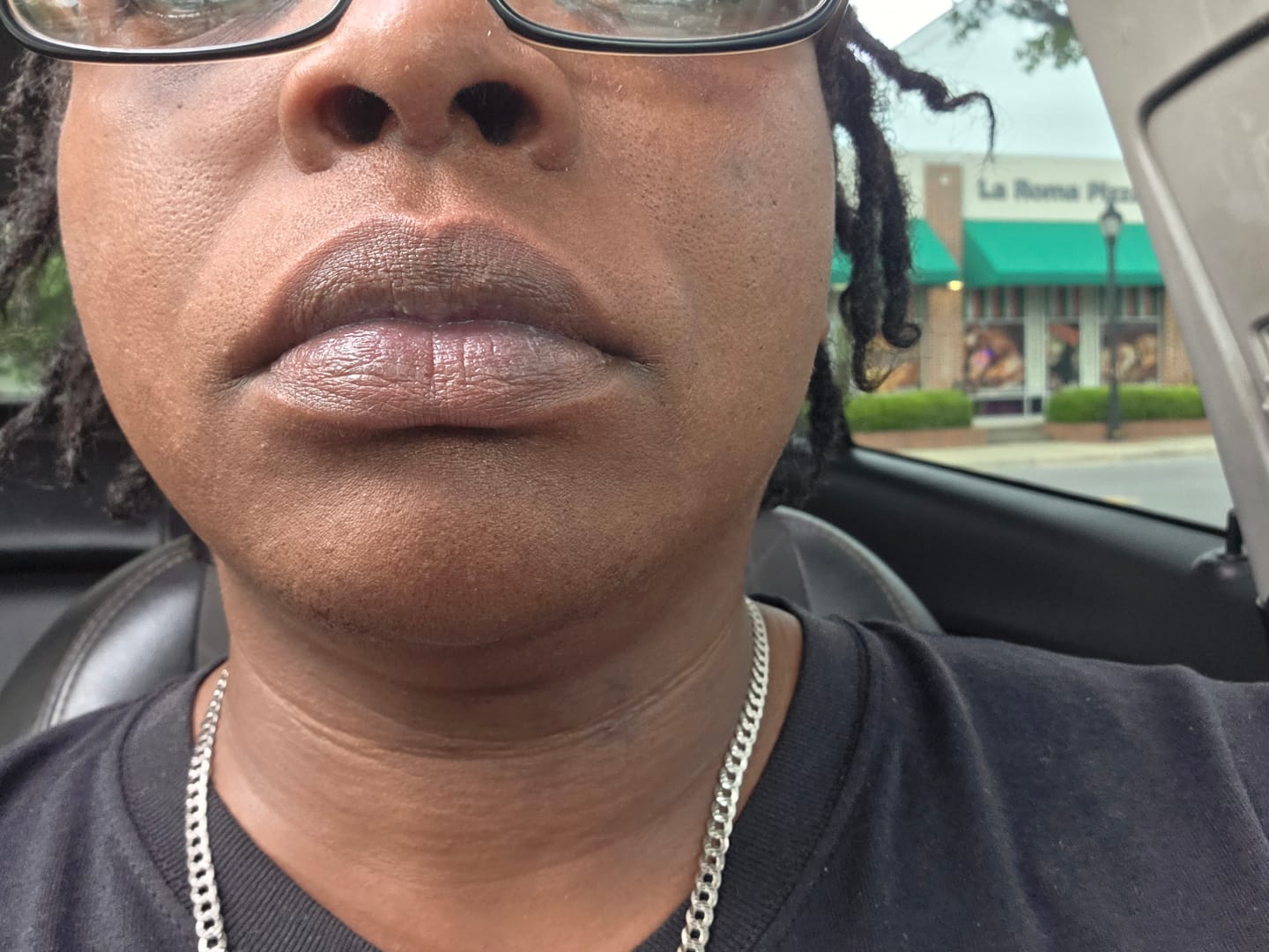 Customer photo review of Brightening Lip Bundle