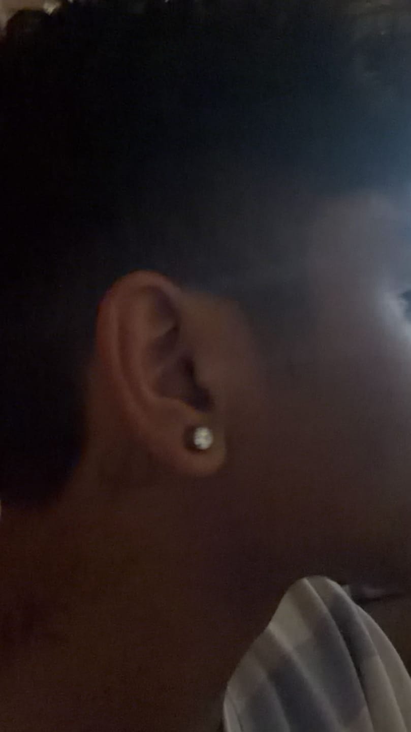 Customer photo review of Round Stud (Magnetic Non-Pierced)