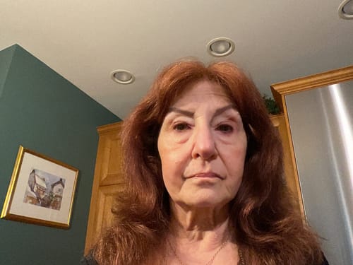 Customer selfie showing her face in a review for the Microneedling Infusion System.