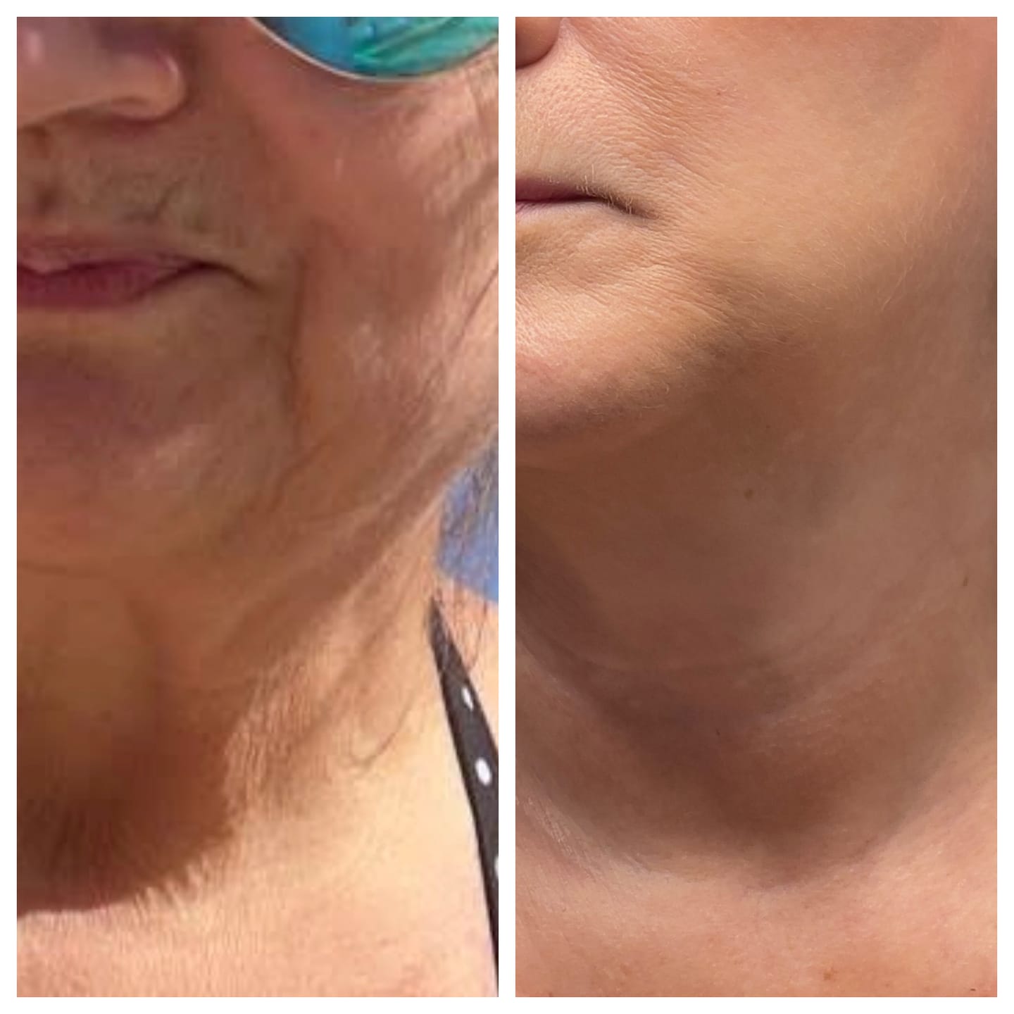 Customer photo review of Whipped Tallow Skin Balm
