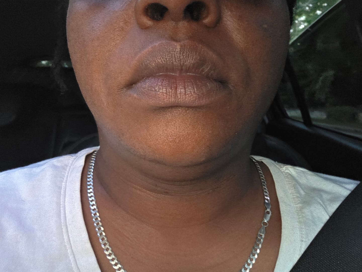 Customer photo review of Magic Eraser Dark Spot Cream