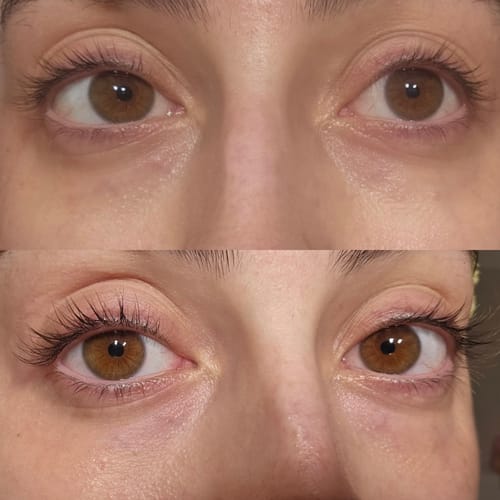 Customer photo review of KosmaLash® | Sérum Crecimiento & Anticaída