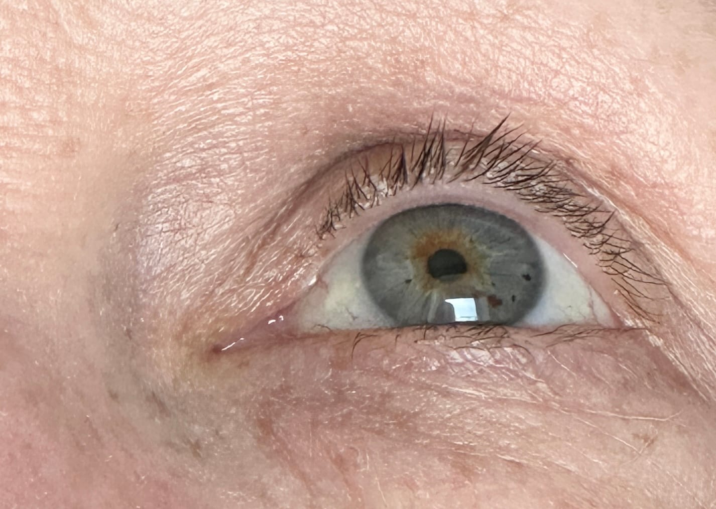 Customer photo review of Eyelash Serum