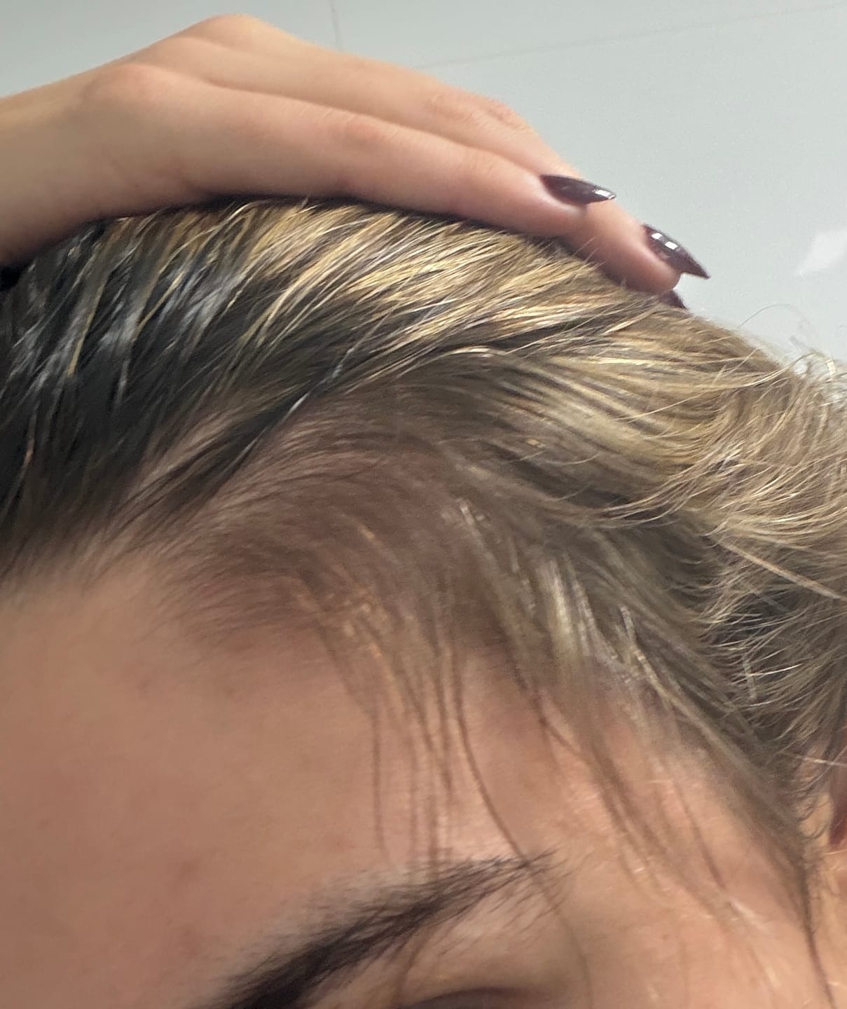 Customer photo review of Gloss Hair Growth Shampoo with GHK-Cu Copper Peptides