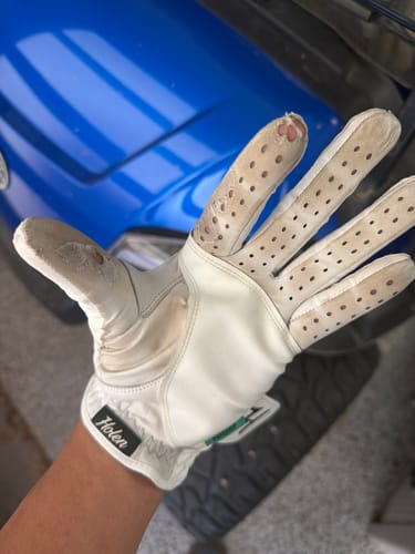 Customer photo review of Holen SureGrip Glove