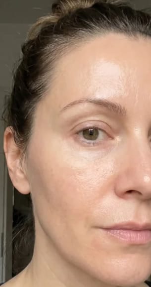 Customer photo review of Anti-Aging Rotlichtmaske Photon X