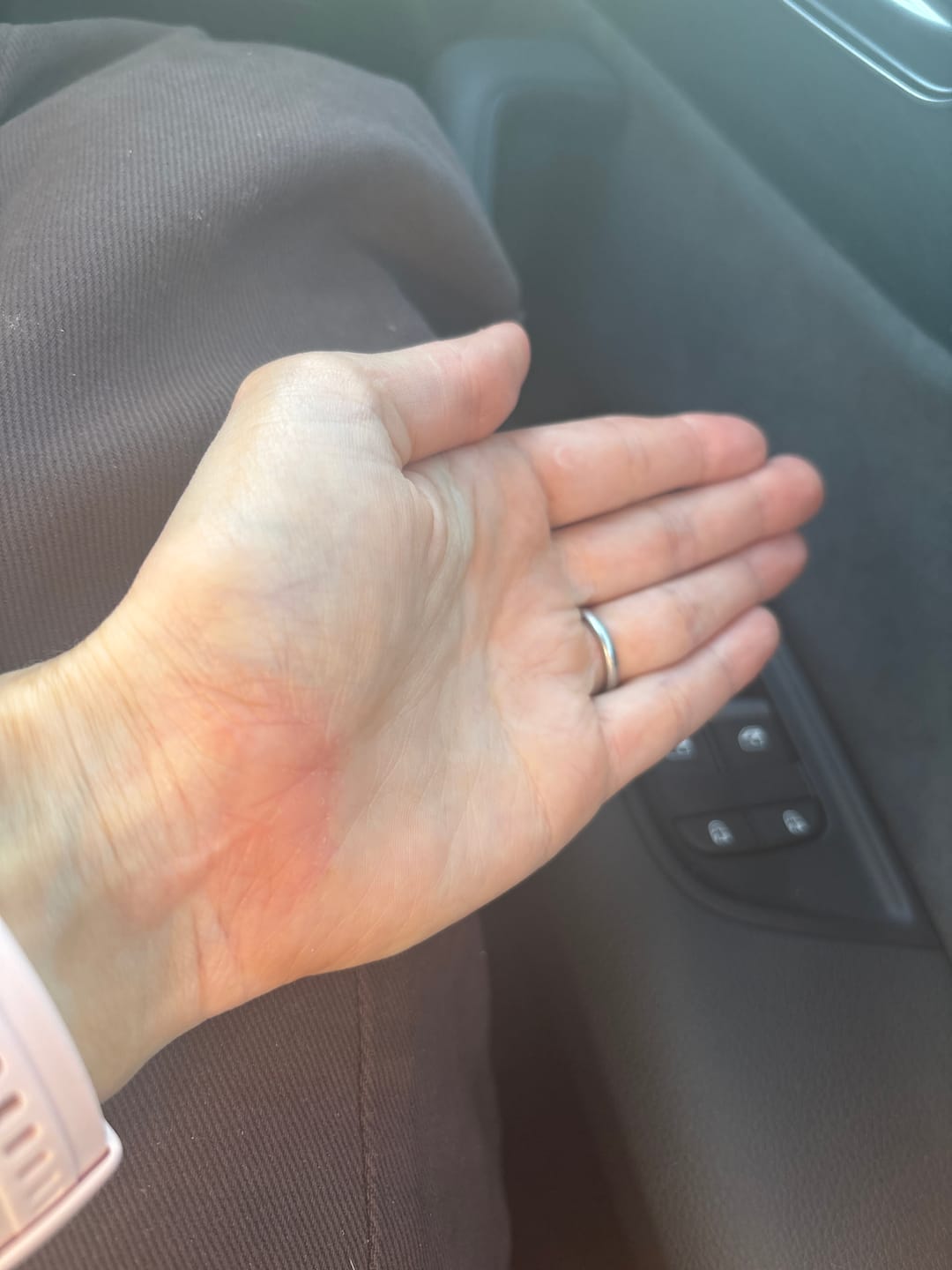 Customer photo review of Multi Strain Biotic
