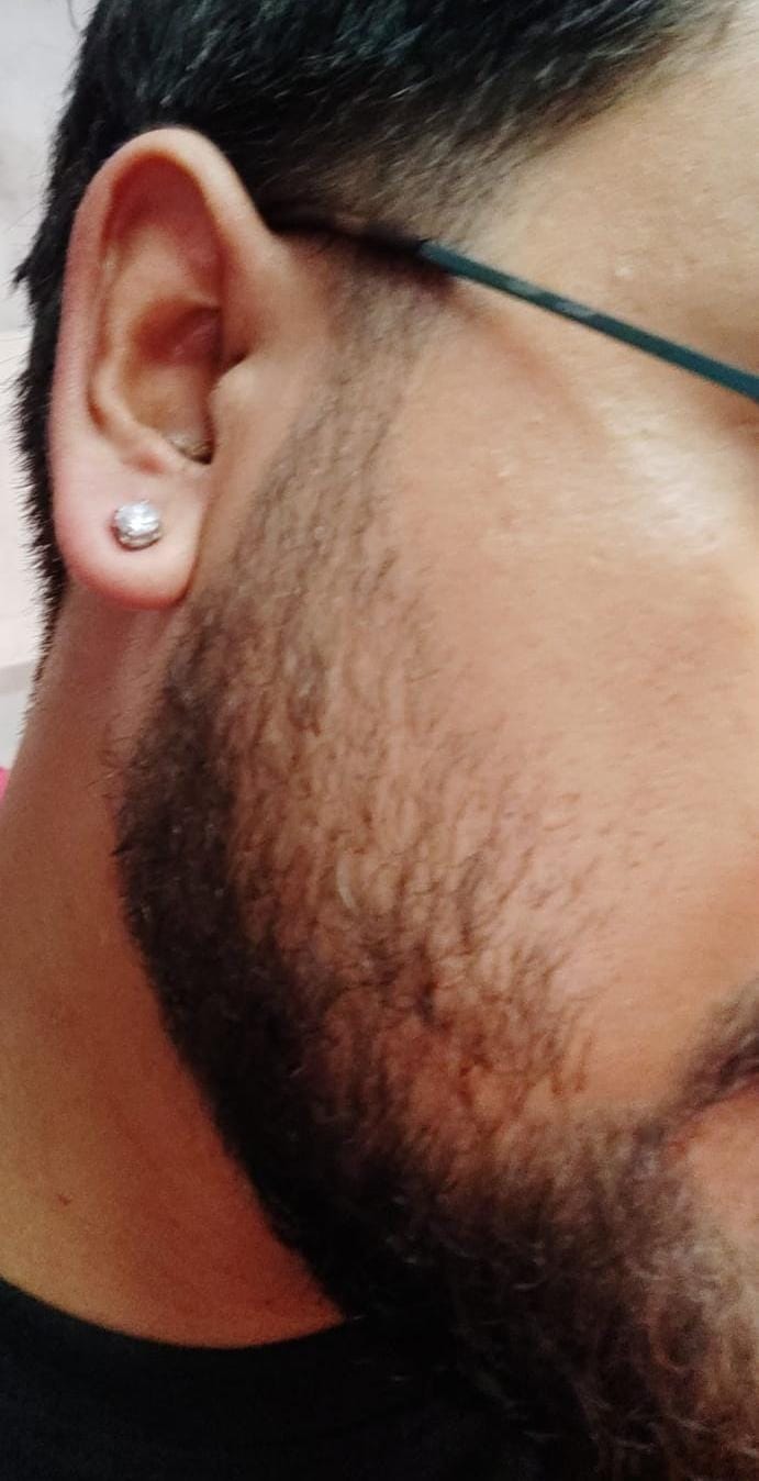 Customer photo review of Ear Stud (Magnetic Non-Pierced)