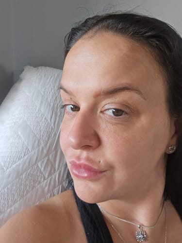 Customer photo review of Seb Natural Calming Serum