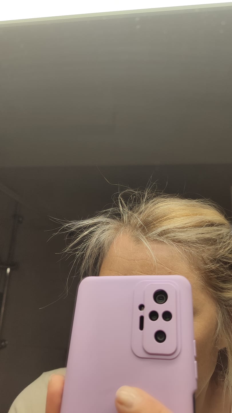 Customer photo review of Φυτικό Σαμπουάν για Τριχόπτωση 200ml