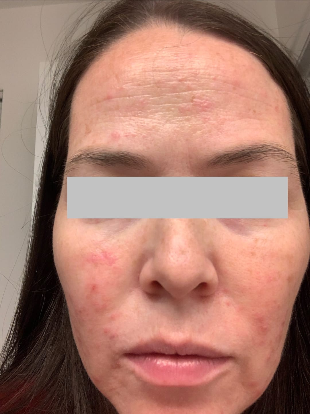 Customer photo review of clear balance trio | microbiome smart system