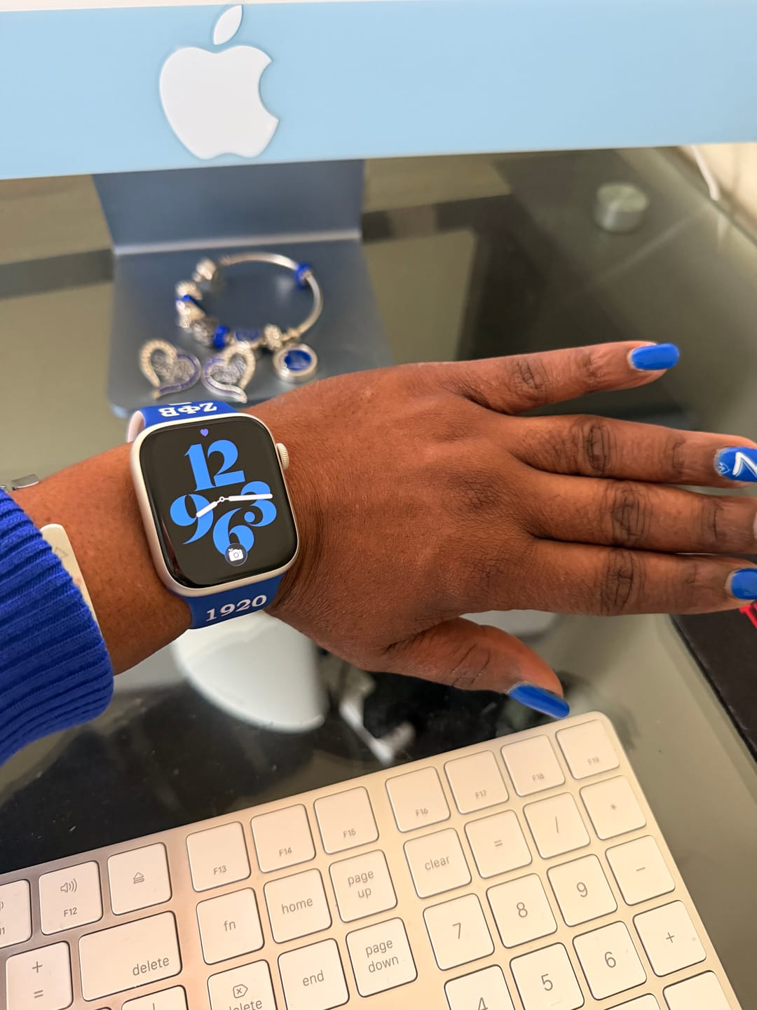 Customer photo review of ZETA WATCH BANDS