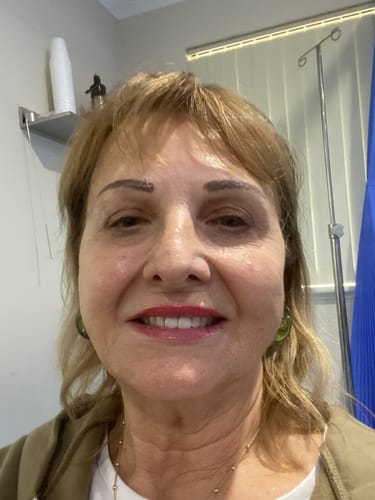 A reviewer's close-up photo showing their clear, smooth skin after using Koriderm™ Time Reverse Cream.