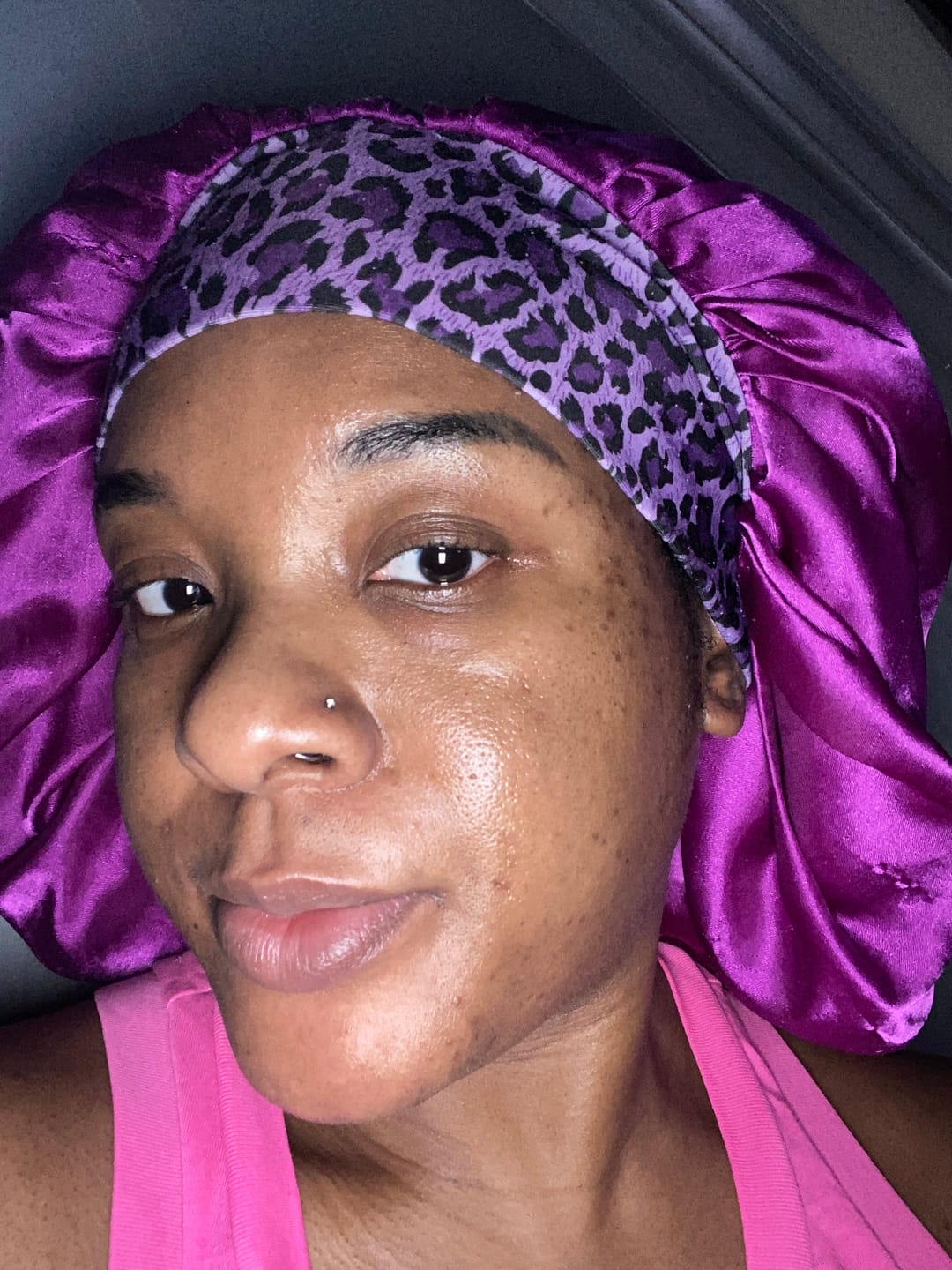 Customer photo review of Turmeric Fade & Glow Bar.