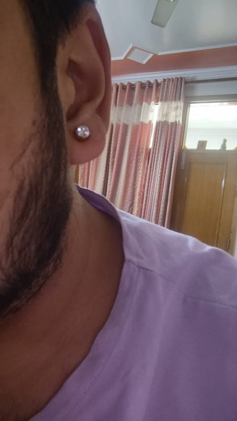 Customer photo review of Round Stud (Magnetic Non-Pierced)