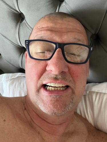 Customer photo review of Click-in Veneers 4.0