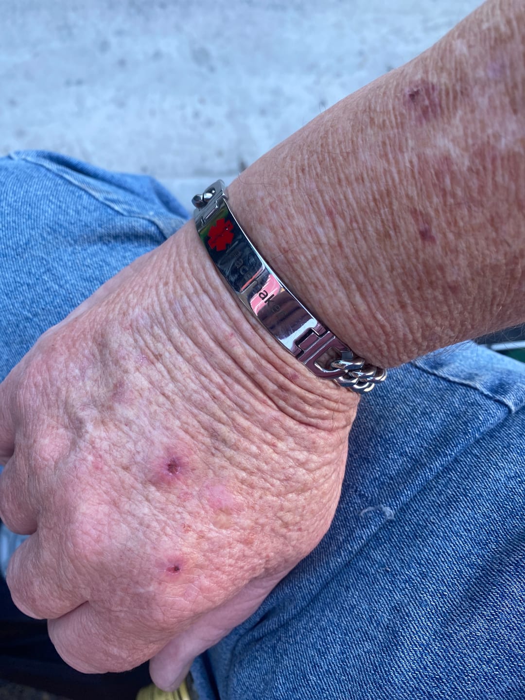 Customer photo review of UniSafe Medical ID Bracelet – Silver with Red Emblem