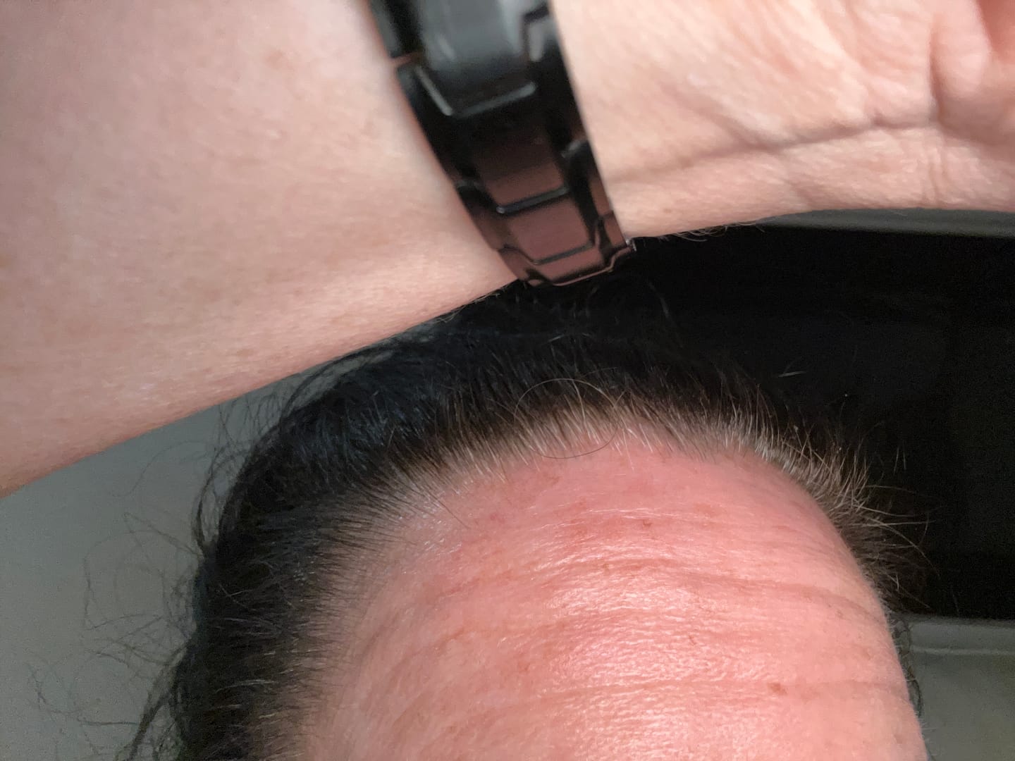 Customer photo review of PEPTIDE-POWERED HAIR SERUM