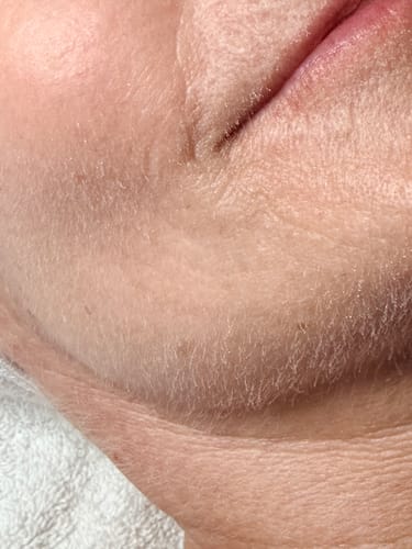 Customer photo review of Dermaplaning Certification: The Ultimate Skin Exfoliation Training