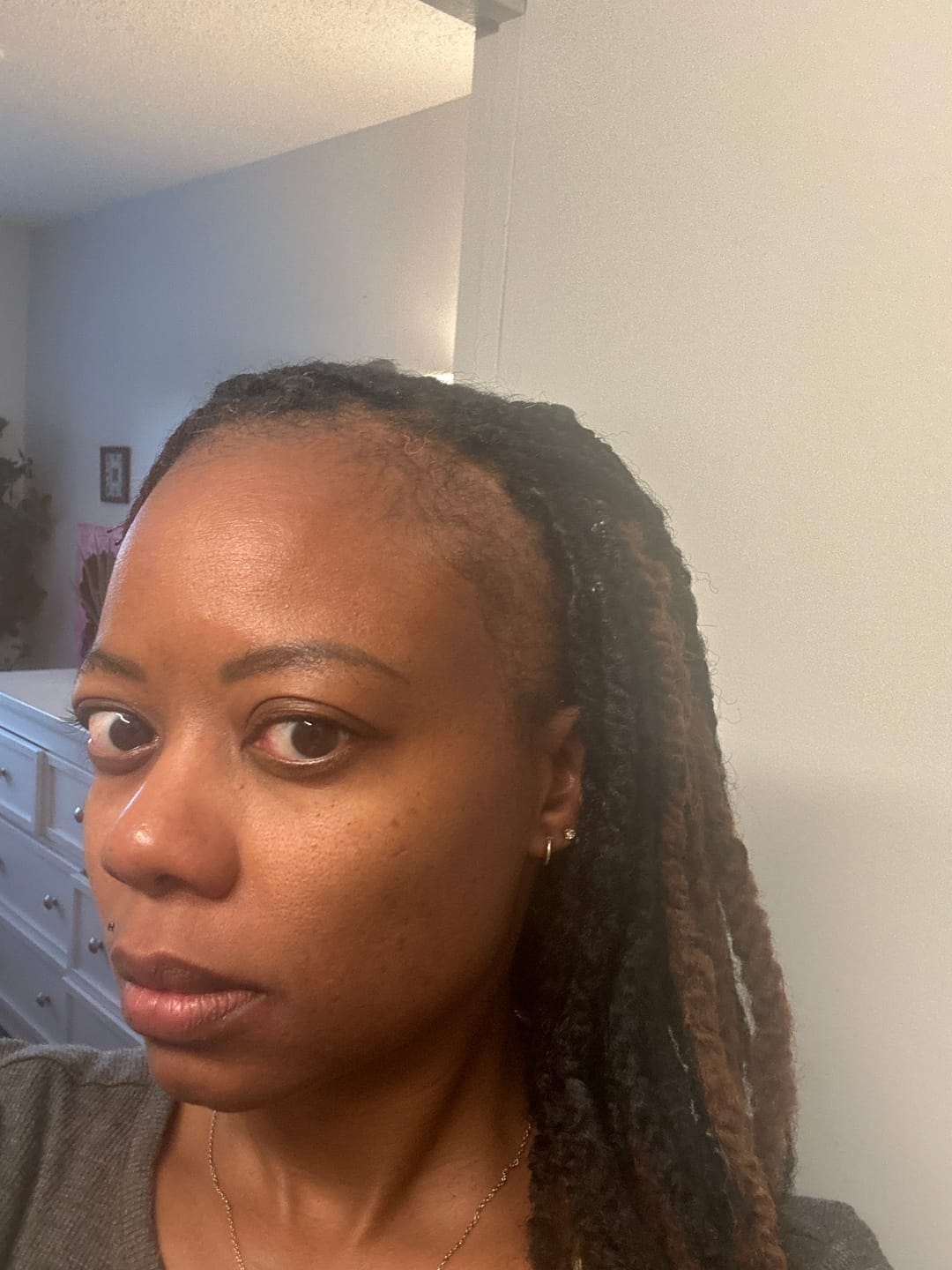 Customer photo review of Rennora Hair Growth Serum