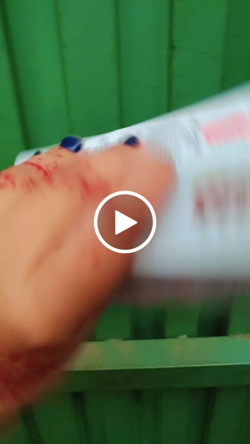 Customer video review of Mela Care Advanced Brightening Cream