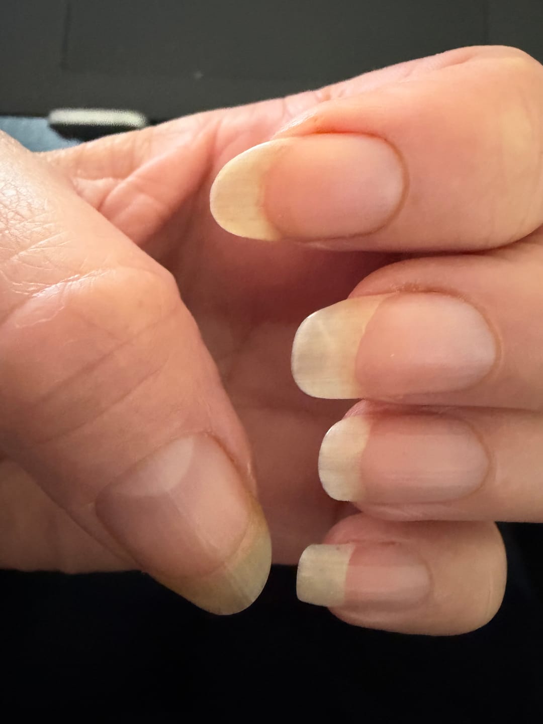 Customer photo review of Tremella Gummies