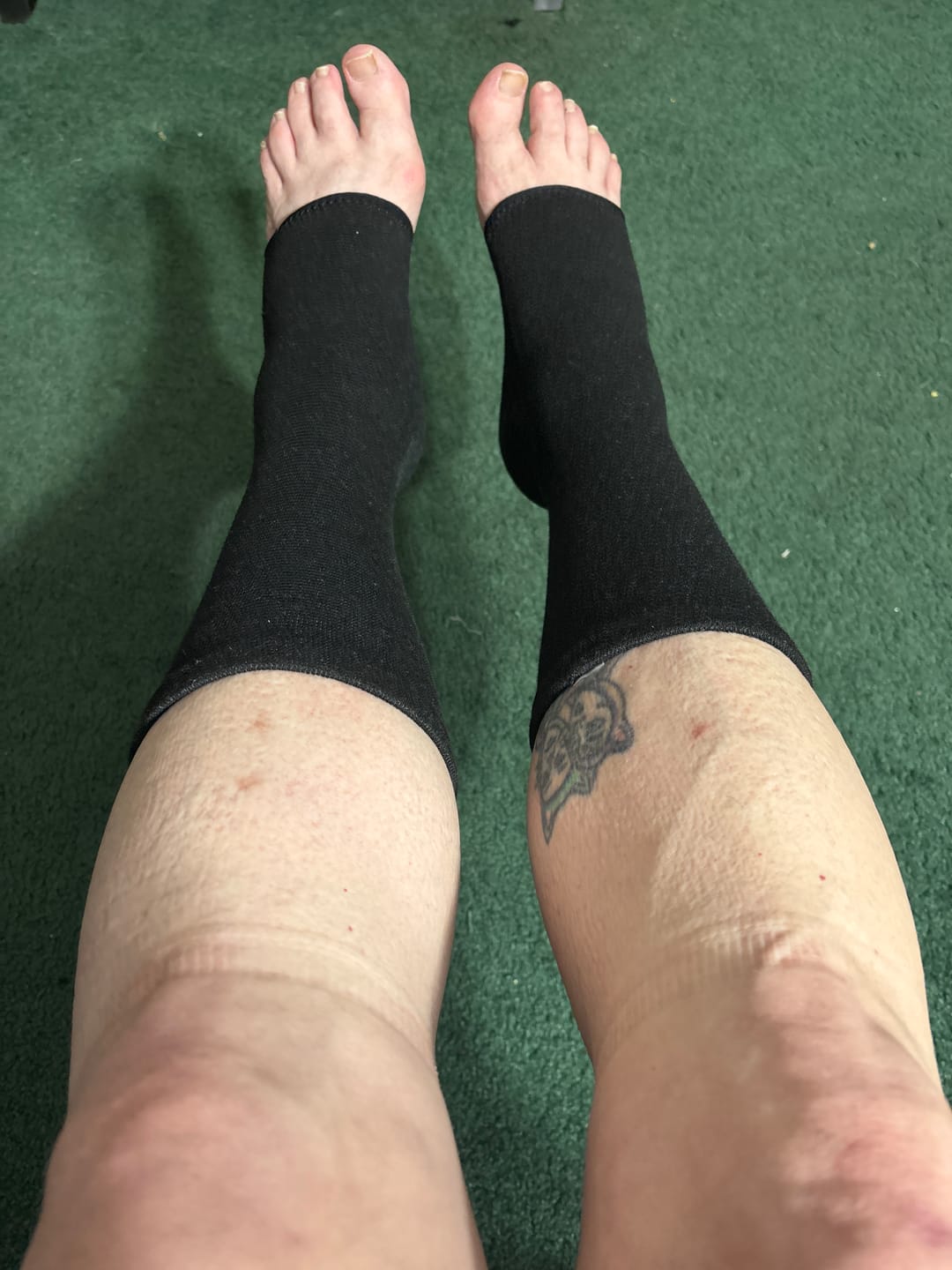Customer photo review of Premium Anti-Fatigue Bamboo Footsleeves