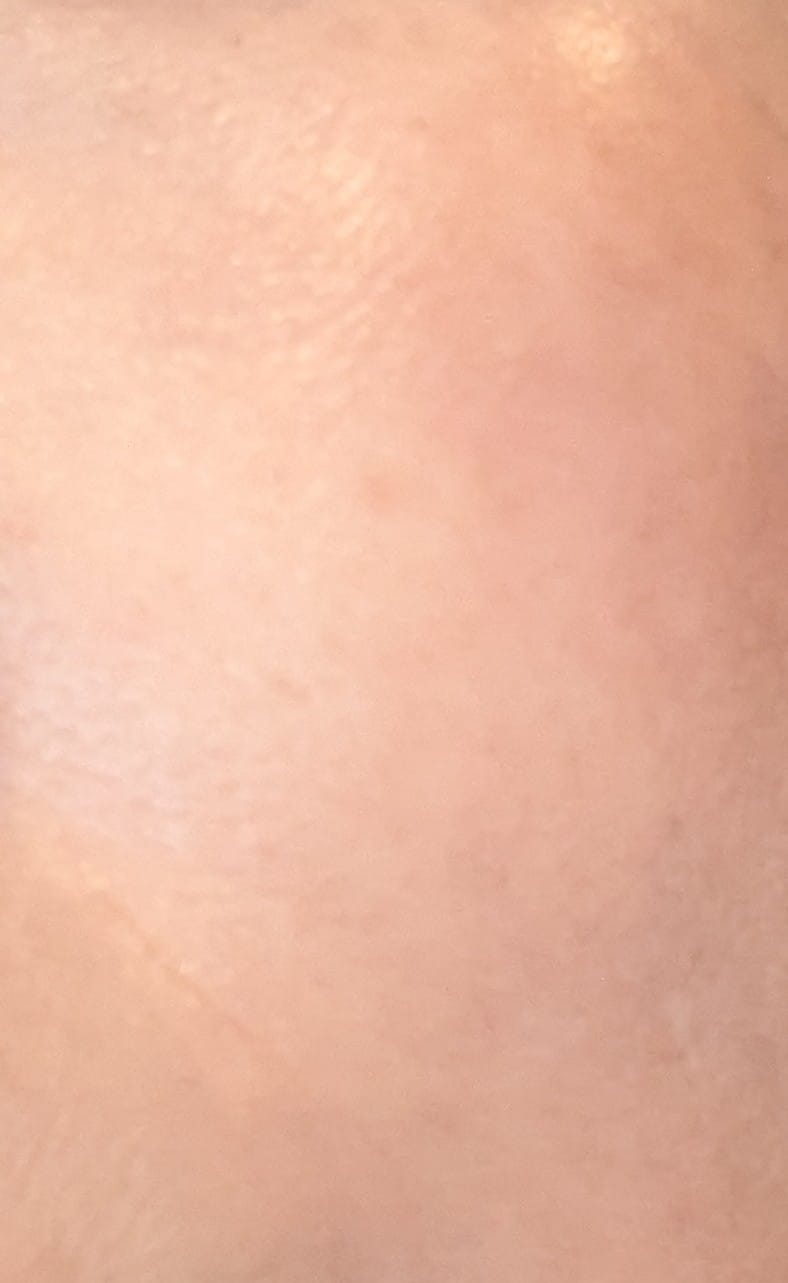 Customer photo review of drNC CONCENTRATED MICROPEEL WIPE PACK