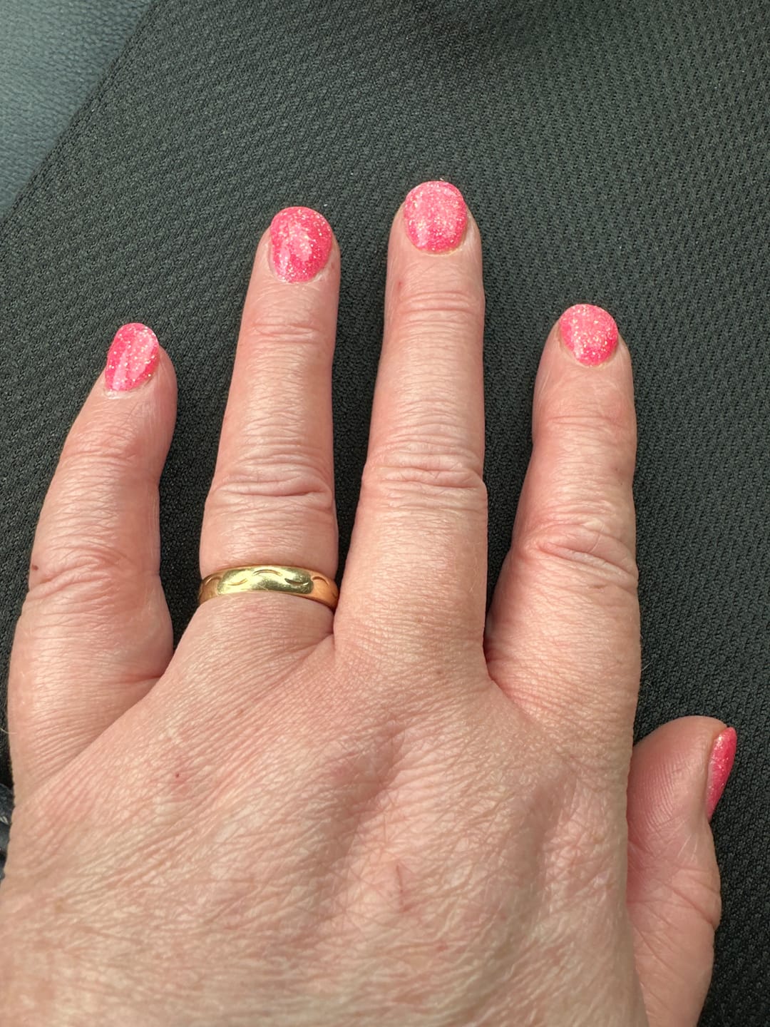 Customer photo review of Verwijderkom