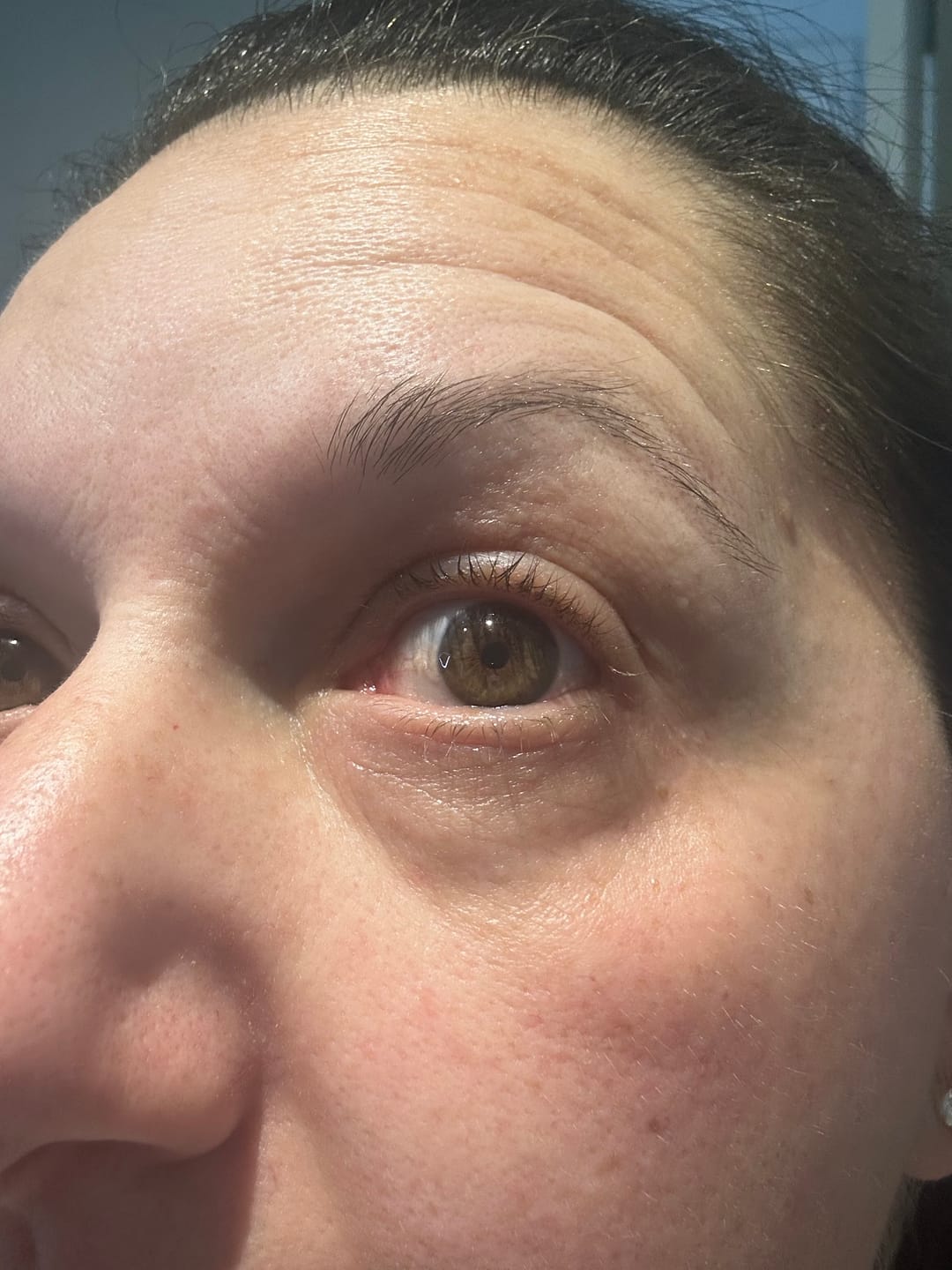 Customer photo review of NEW & IMPROVED LASH SERUM