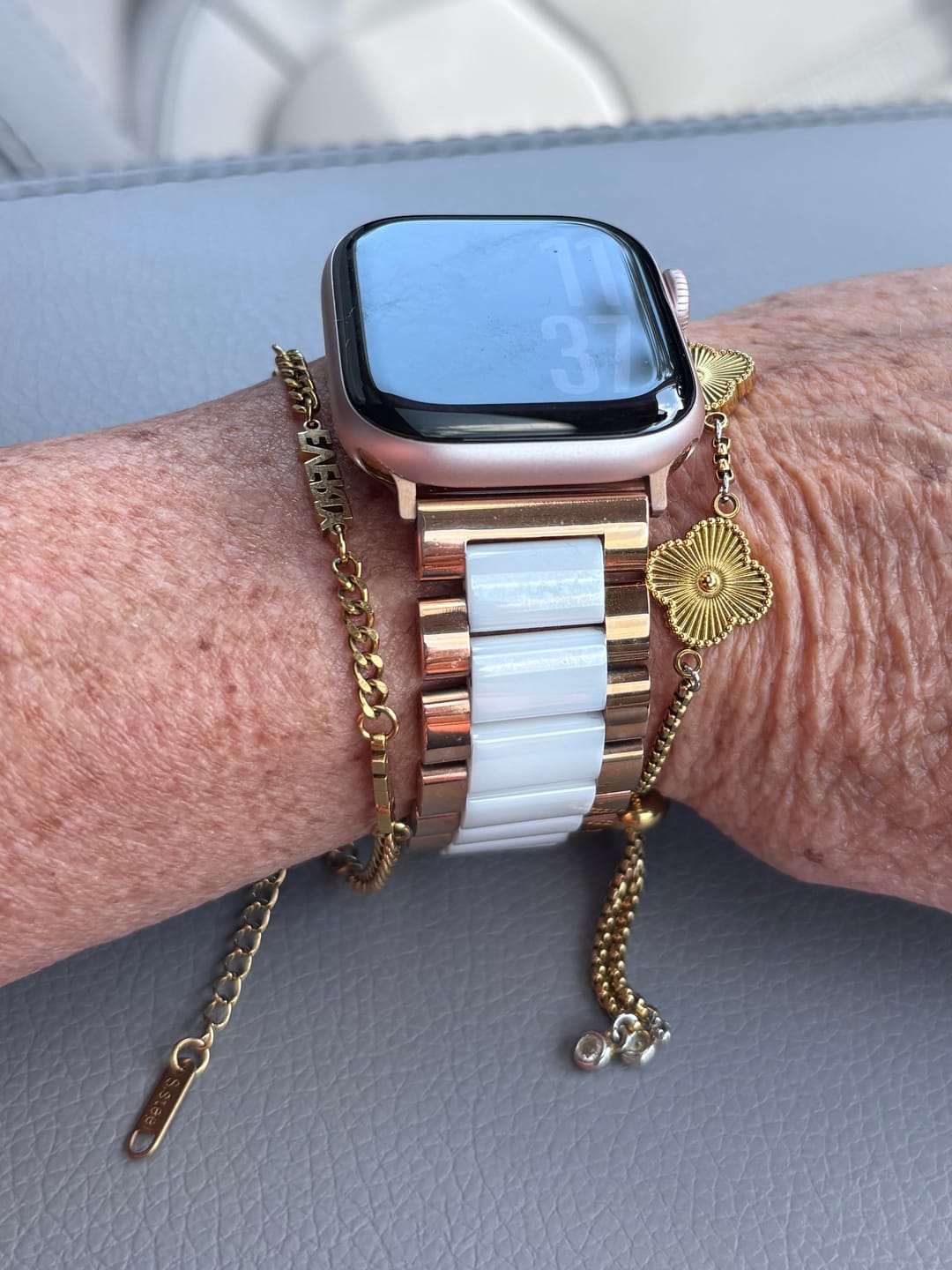 Customer photo review of Granum Ceramic Strap