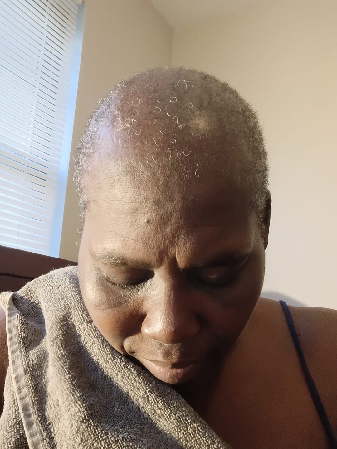 Customer photo review of Rennora Hair Growth Serum