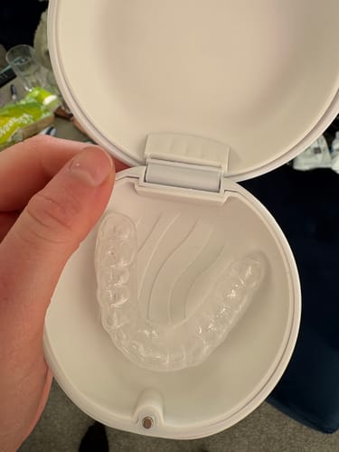 Customer photo review of 3.0mm Soft Night Guards